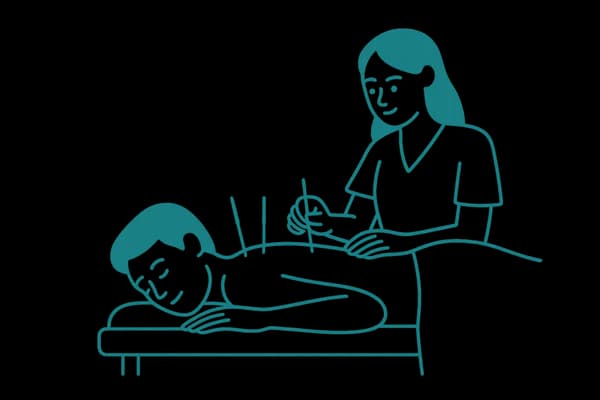 Акупунктура